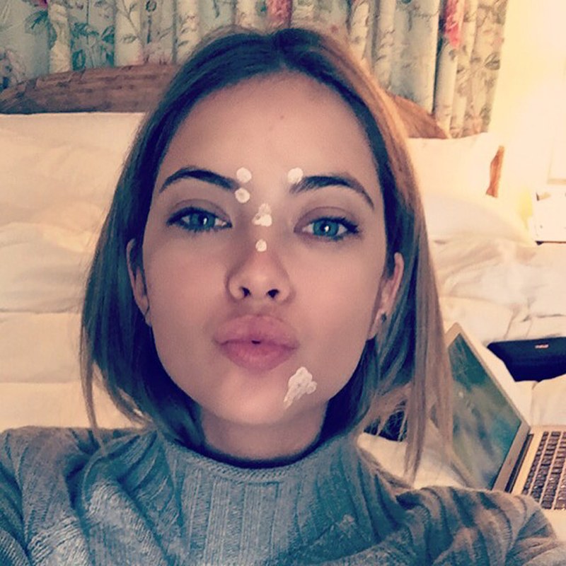 acne celebs 10