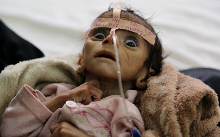 19yemen