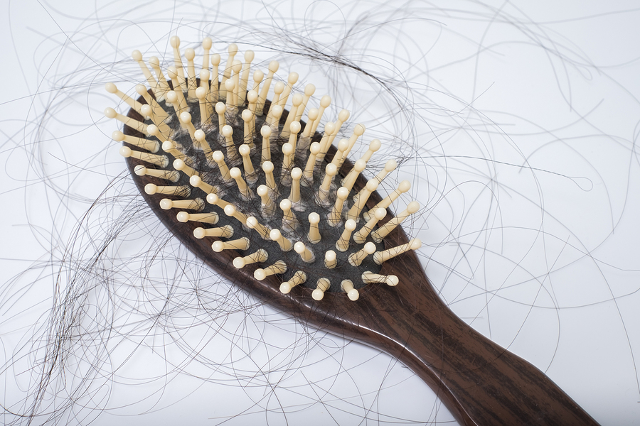 bigstock Hair Loss Problem On Bruch On 98343899