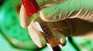 Νέες αντιικές φαρμακευτικές αγωγές κατά της ηπατίτιδας