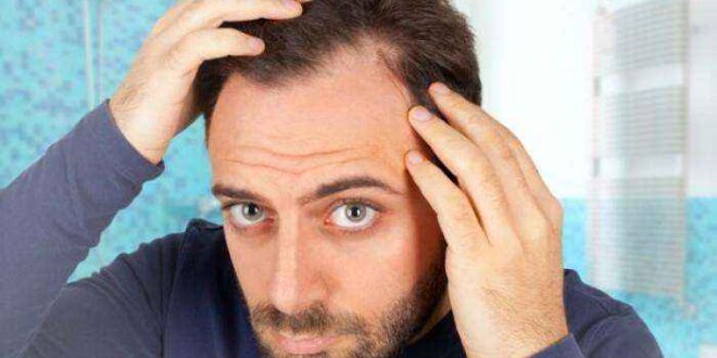 Απώλεια μαλλιών: Οι 5 βιταμίνες που θα σας σώσουν