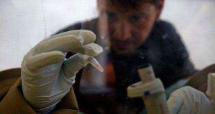 Τι πρέπει να γνωρίζουμε για τον ιό Έμπολα