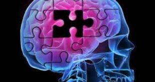 Εγκεφαλικό αποτύπωμα μαρτυρά το Αλτσχάιμερ