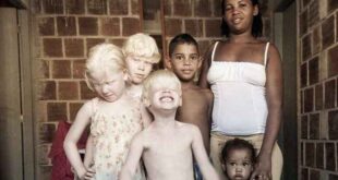 Η μαύρη μητέρα που γέννησε τρία λευκά παιδιά