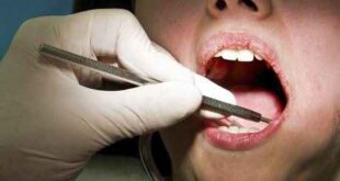 Πώς τα δόντια επηρεάζουν την υγεία μας