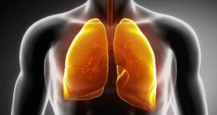 Η Χρόνια Αποφρακτική Πνευμονοπάθεια (ΧΑΠ) οφείλεται κατά 80-90% στο κάπνισμα. Είναι η τέταρτη αιτία θανάτου παγκοσμίως