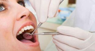 Τι χρειάζεται να γνωρίζετε για τα οδοντικά εμφυτεύματα