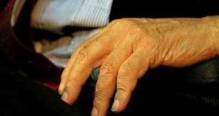 Εξέταση δέρματος καμπανάκι για Αλτσχάιμερ και Πάρκινσον