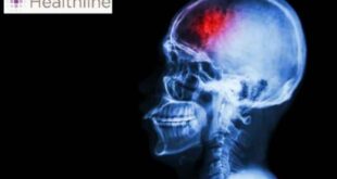 «Μίνι» εγκεφαλικό: Μάθετε τα συμπτώματα!