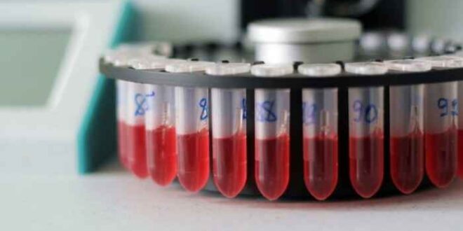 Ομάδα αίματος: Η σπάνια, η συνηθισμένη και τι ισχύει για τις μεταγγίσεις