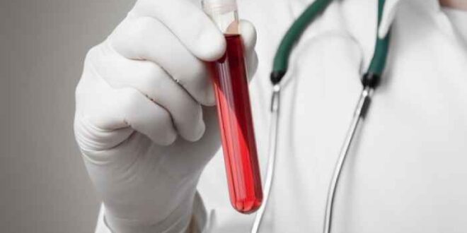 Αιμοχρωμάτωση: Τι είναι και πώς αντιμετωπίζεται