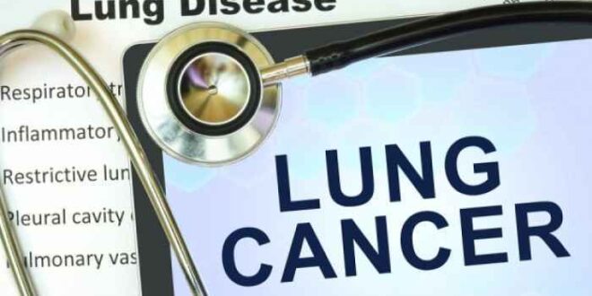 Καρκίνος Πνεύμονα: Λανθασμένες αντιλήψεις και ελλιπής γνώση από τον πληθυσμό, σύμφωνα με έρευνα