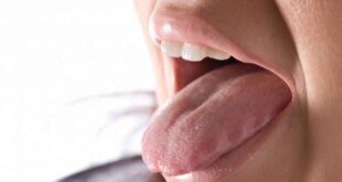 Άσχημη γεύση στο στόμα: Αυτές είναι οι πιθανές αιτίες