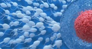 Ανδρική στειρότητα: Επιστήμονες έφτιαξαν για πρώτη φορά σπερματοζωάρια στο εργαστήριο