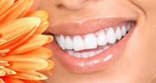Λεύκανση δοντιών: Δείτε με ποιες μεθόδους γίνεται