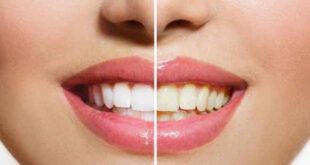 Τα καλύτερα tricks για λευκά δόντια