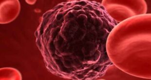 Τεστ θα ανιχνεύει τον καρκίνο ως και 13 χρόνια νωρίτερα