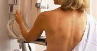 Η μαστογραφία μειώνει τον κίνδυνο καρκίνου του μαστού