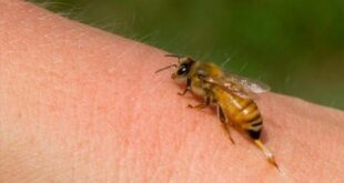 «Μέλισσα τσίμπησε το παιδί μου!» Δείτε τι πρέπει να κάνετε