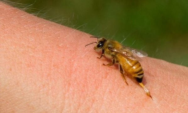 «Μέλισσα τσίμπησε το παιδί μου!» Δείτε τι πρέπει να κάνετε