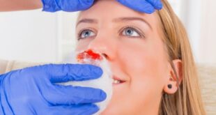 Αίμα από τη μύτη το καλοκαίρι: Γιατί συμβαίνει και πώς θα το σταματήσετε