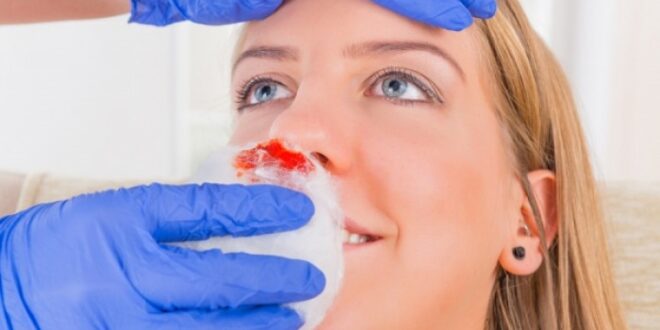 Αίμα από τη μύτη το καλοκαίρι: Γιατί συμβαίνει και πώς θα το σταματήσετε