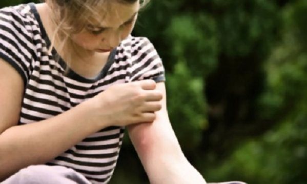 Πολύτιμες συμβουλές για να μην τσιμπήσει το παιδί σας κουνούπι!