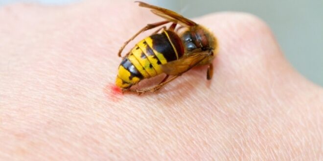 Τσίμπημα από σφήκα, μέλισσα, σκορπιό: Τι πρέπει να κάνετε