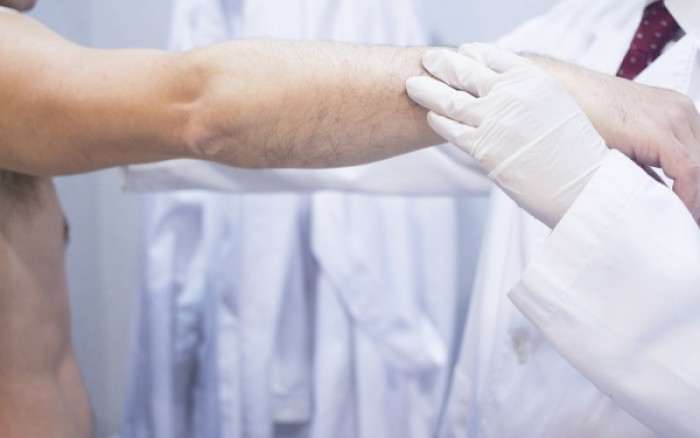 Τα σημάδια στο δέρμα που δείχνουν πρόβλημα στο γαστρεντερικό