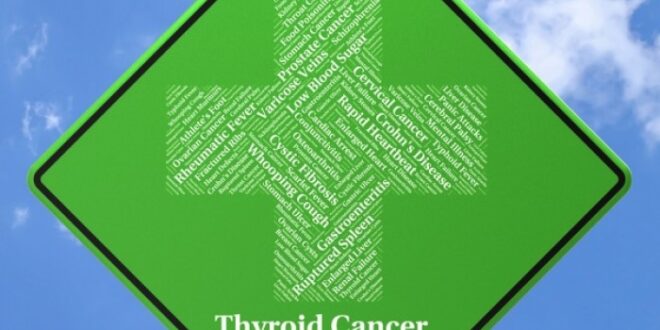 Καρκίνος του θυρεοειδούς: Η πιο συχνή ενδοκρινική κακοήθεια