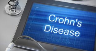 Νόσος του Crohn: Ποια είναι η κατάλληλη διατροφή