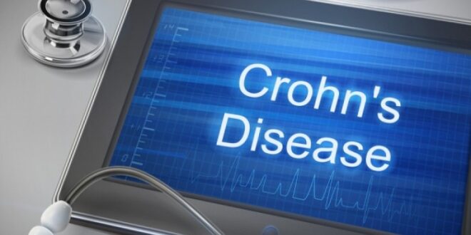 Νόσος του Crohn: Ποια είναι η κατάλληλη διατροφή