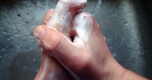 Δείτε πόσα μικρόβια υπάρχουν στα χέρια αμέσως μετά το πλύσιμο (φωτογραφίες)