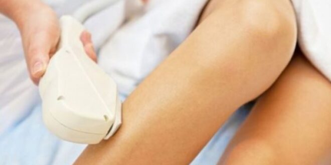 Είναι ασφαλής η αποτρίχωση με laser στην εγκυμοσύνη;