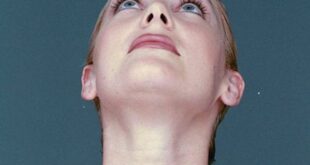 Πώς να αντιμετωπίσετε τις ρυτίδες στο λαιμό