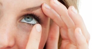 Κόλλησε ο φακός επαφής στο μάτι; Τι πρέπει να κάνετε