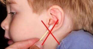 «Πρέπει να καθαρίζω τα αυτιά του παιδιού μου; Οι μπατονέτες βοηθούν ή όχι;»