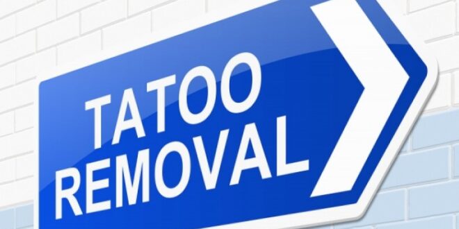 Αφαίρεση τατουάζ: Πώς γίνεται; Πόσο αποτελεσματική είναι;