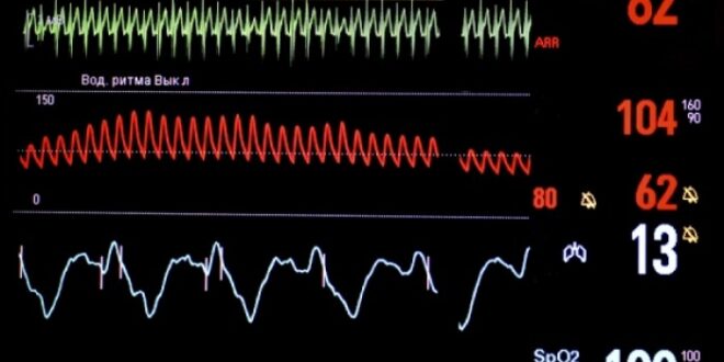 Καρδιακή ανεπάρκεια: Τι είναι, ποια η συχνότητα και τα νεότερα στη φαρμακευτική αντιμετώπιση