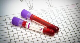 Χαμηλά λευκά αιμοσφαίρια: Ποιες είναι οι αιτίες