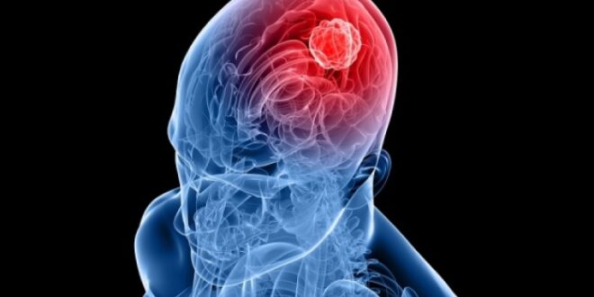Καρκίνος εγκεφάλου: Τα ροφήματα που μειώνουν κατά 34% τον κίνδυνο