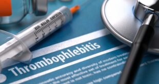 Θρομβοφλεβίτιδα: Ποιοι κινδυνεύουν περισσότερο