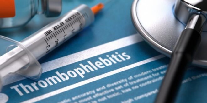 Θρομβοφλεβίτιδα: Ποιοι κινδυνεύουν περισσότερο