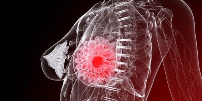 Νέοι δρόμοι στη θεραπεία του καρκίνου του μαστού χάρη σε νεαρό Έλληνα ερευνητή