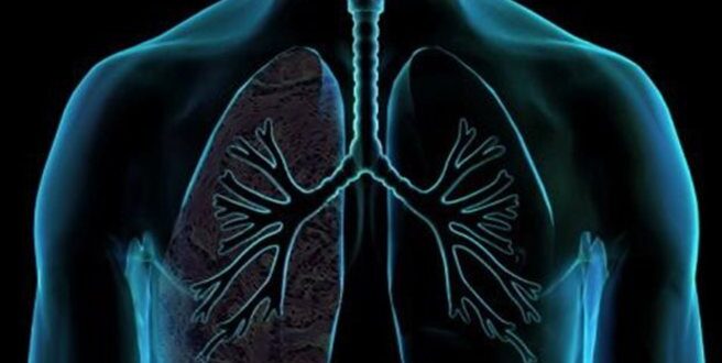 Πώς συνδέονται οι υδατάνθρακες με τον καρκίνο του πνεύμονα