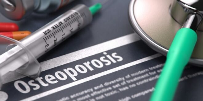 Οστεοπόρωση: Ποιοι παράγοντες αυξάνουν τον κίνδυνο, πώς θα την καθυστερήσετε