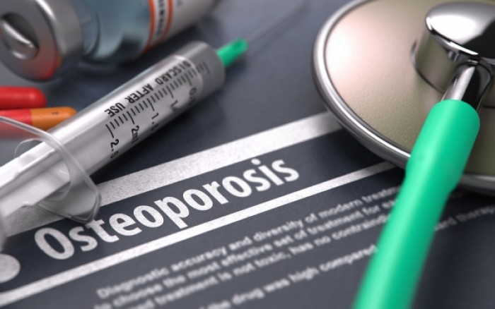 Οστεοπόρωση: Ο ρόλος της φαρμακευτικής αγωγής και πότε μπορεί να διακοπεί