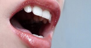Καρκίνος του στόματος: Ποια διατροφή μειώνει τις πιθανότητες