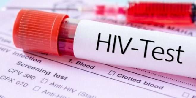 HIV: Νέα θεραπεία αντισωμάτων καθυστερεί την επανεμφάνιση του ιού