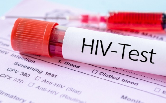 HIV: Νέα θεραπεία αντισωμάτων καθυστερεί την επανεμφάνιση του ιού